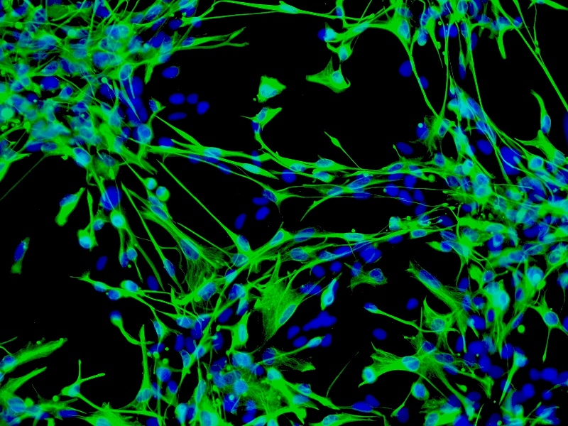 星形胶质细胞激活图片